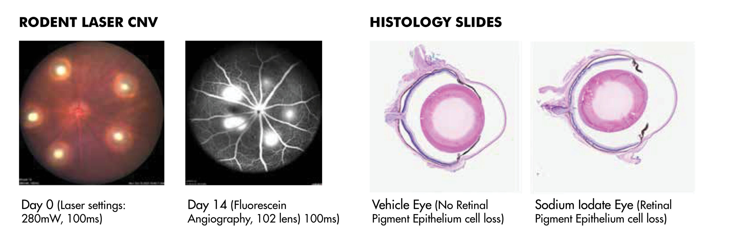 Rodent Laser CNV and Histology Slides