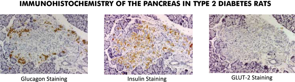 Immunohistochemistry of the Pancreas in Type 2 Diabetes Rats