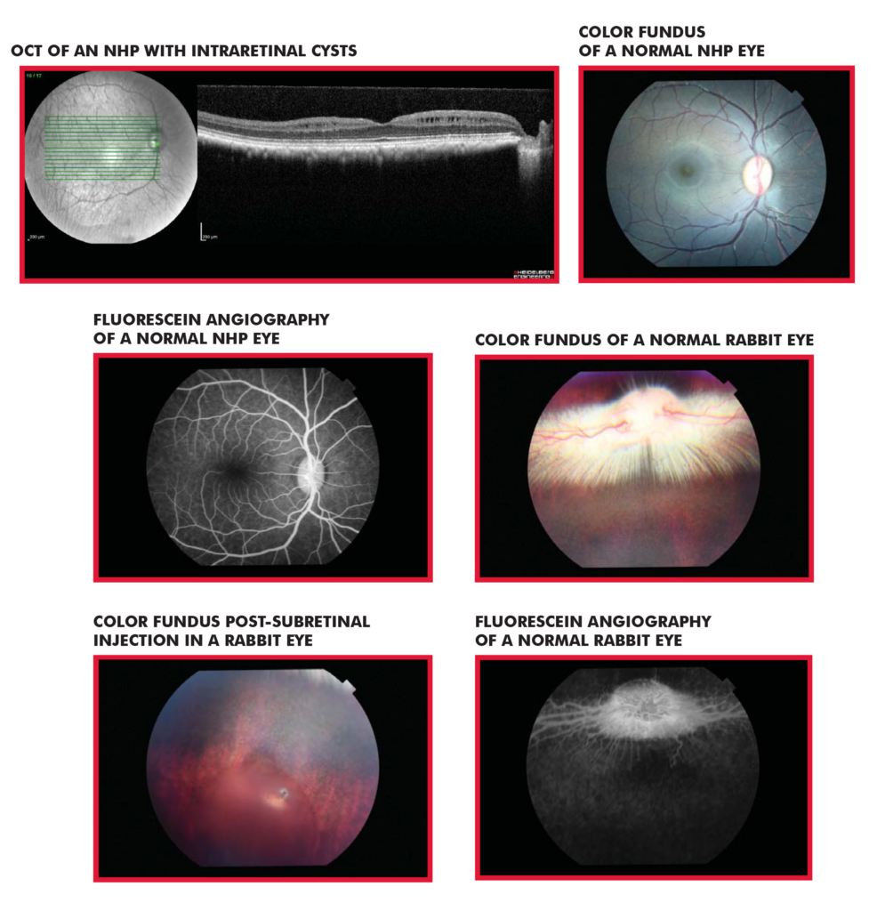 OcularB2