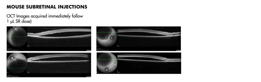 Mouse Subretinal Injections